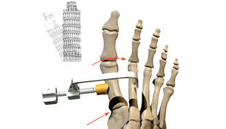 Leaning Tower of Pisa and Foot  Graphic